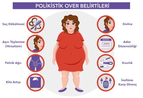 Polikistik Over (PCOS) Belirtileri ?